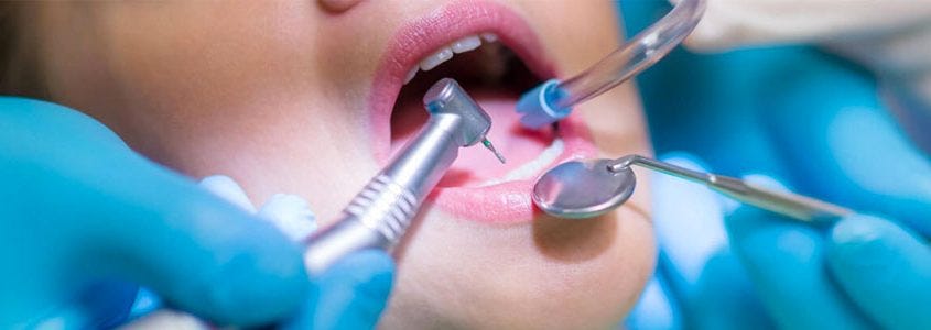 dental implants periodontist