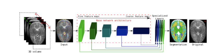 brain image segmentation using machine learning