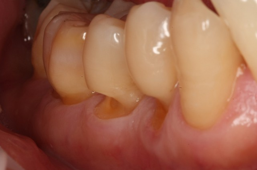 Charcoal Toothpaste: A Dentist's Perspective | by Dr. Igor Khabensky | Medium Charcoal Toothpaste: A Dentist's Perspective | by Dr. Igor Khabensky | Medium