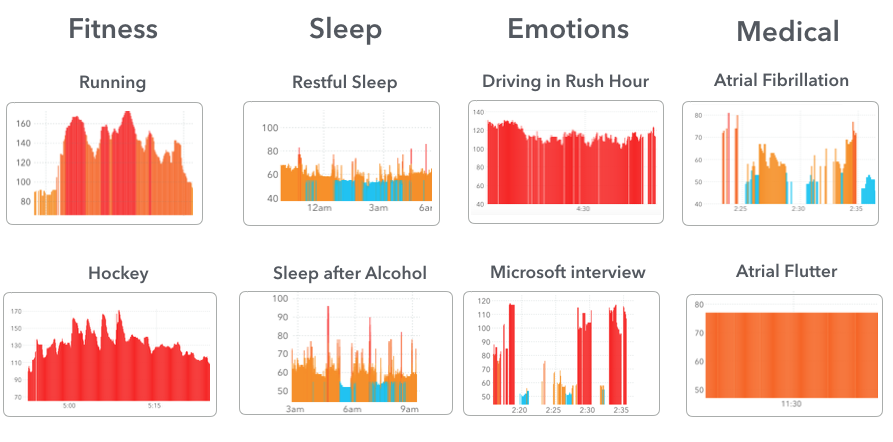 Sleeping Pulse Chart