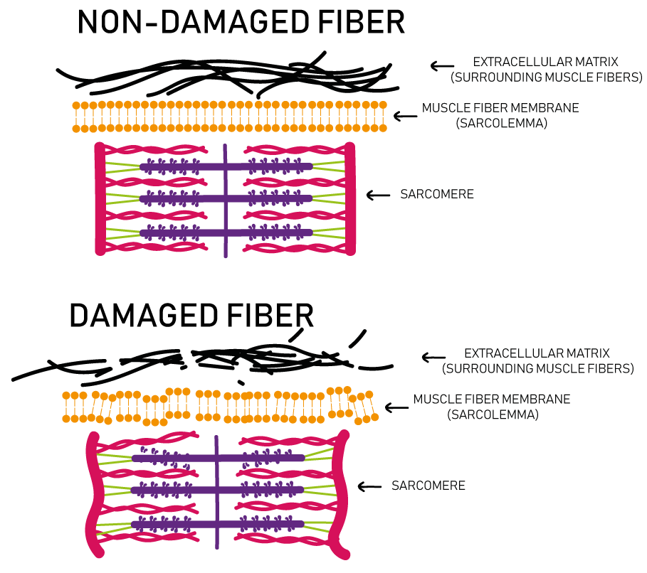 Does Muscle Damage Cause Muscle Growth? by Dhimant Indrayan House