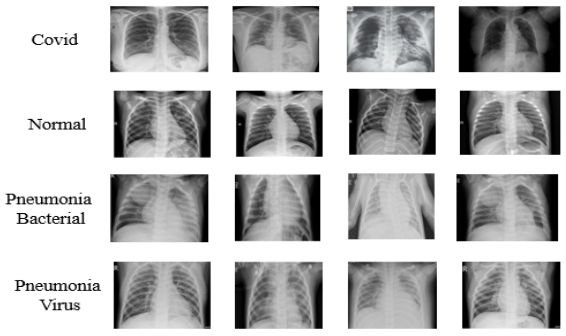 Classification Of Chest Xrays Using Pytorch By Maryam Raji Analytics Vidhya Medium