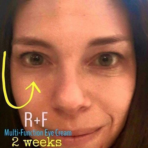 rodan eye cream