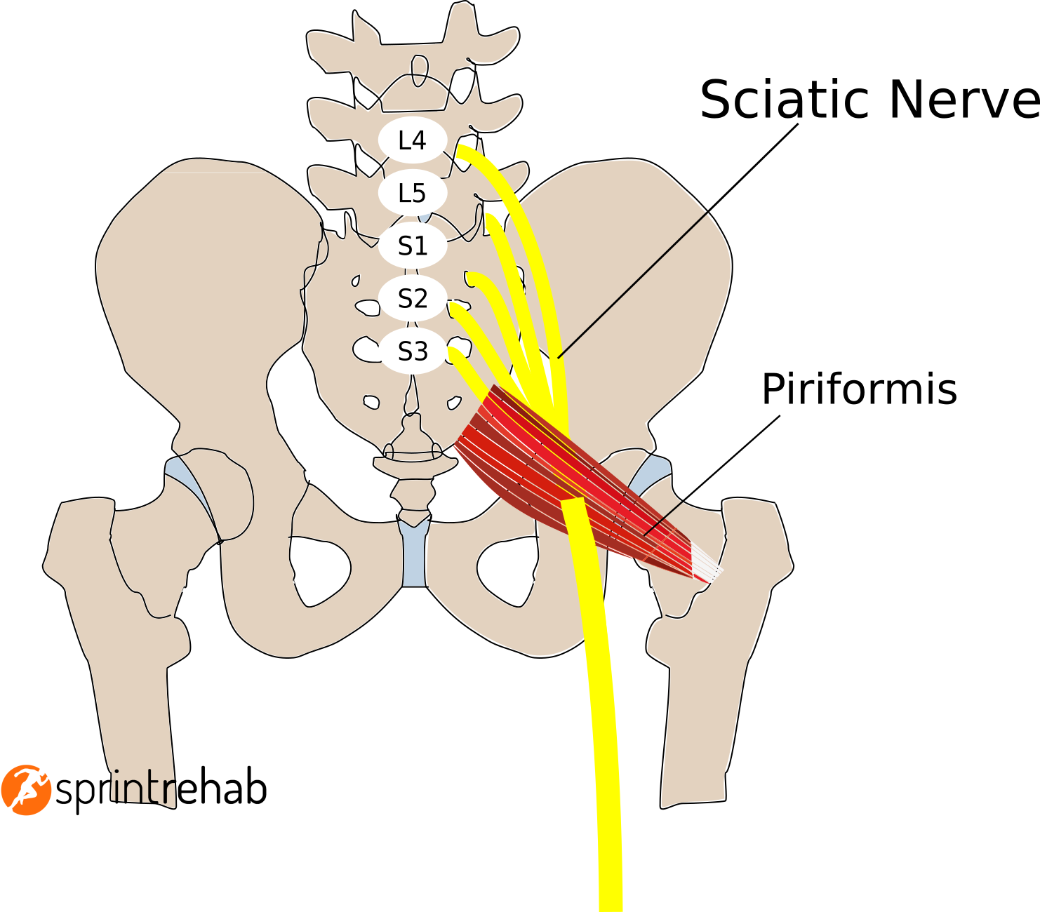 Piriformis Syndrome: A Real Pain in the Butt
