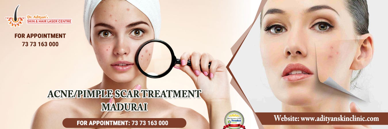 best skin clinic for acne scars