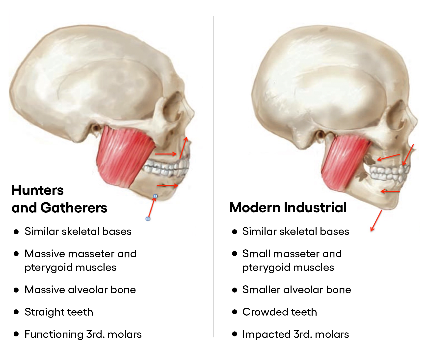 Our Skulls Are Out Evolving Us A Motley Crew Of Scientists Argue That By Katherine Reynolds Lewis Onezero