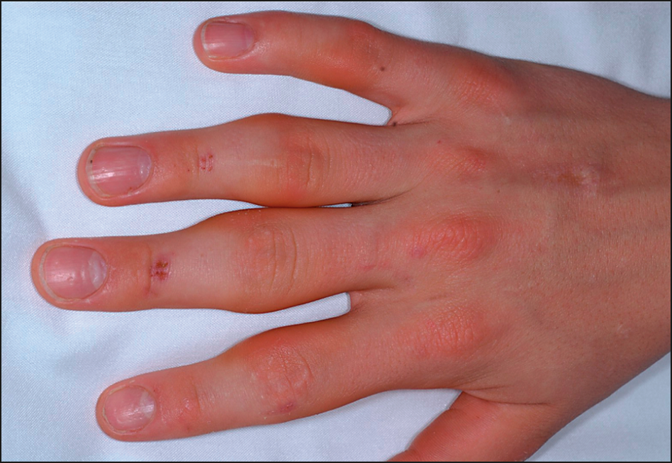 typing fingers curved typing fingers curved