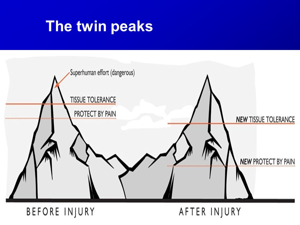 Exercising when it hurts. A step by step guide by Tom Jesson Medium