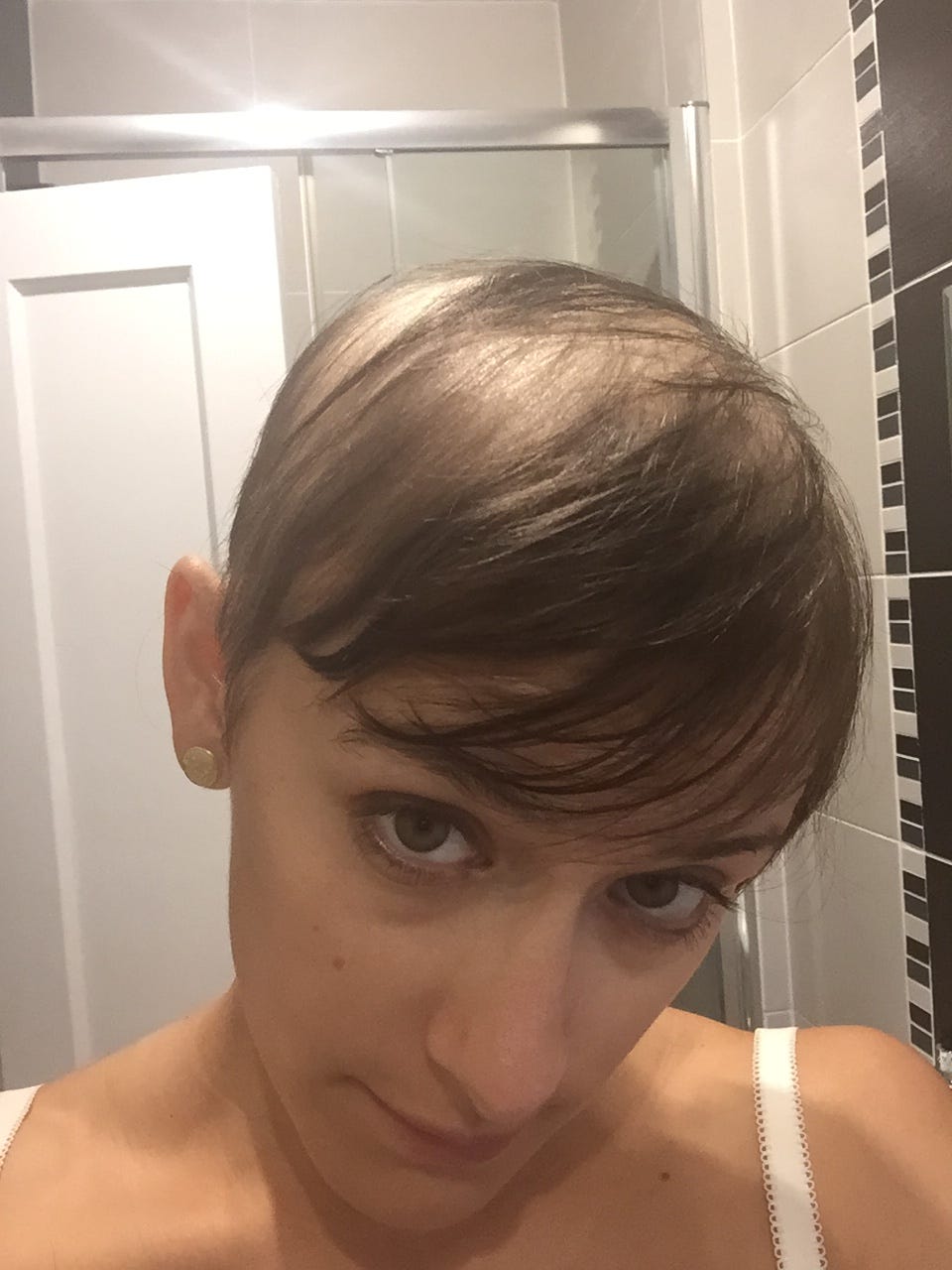 Losing My Religion Or Just My Hair Laurentedaldi Medium