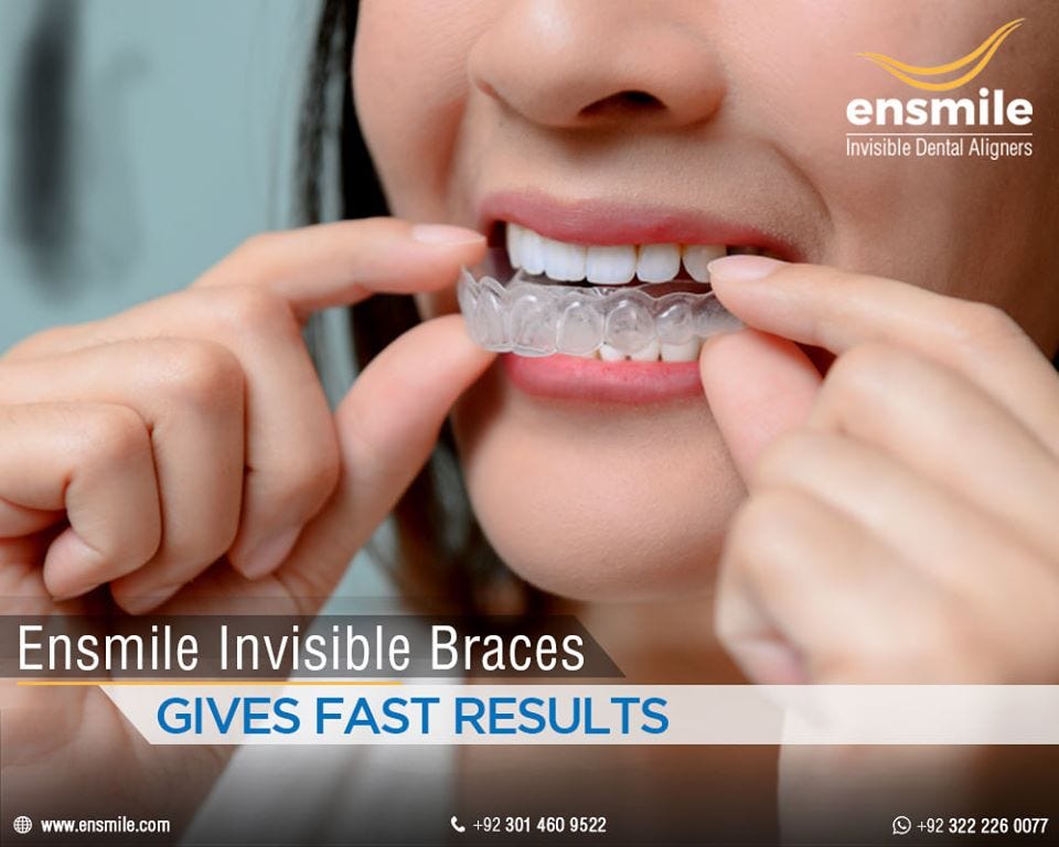 Invisible Braces In Lahore A Clear Way To A Winning Smile By