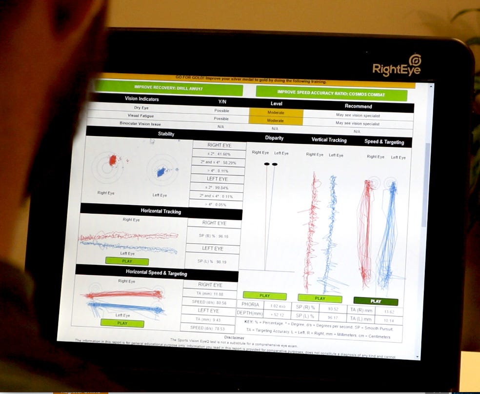 Eye Tracking Drives Innovation In Healthcare Righteye Use Case By Camila Official Eye Tracking Blog