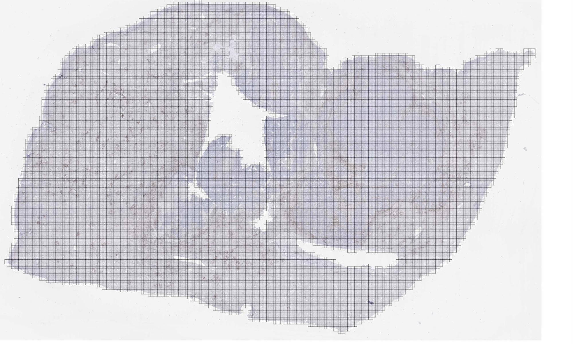 digital pathology 4