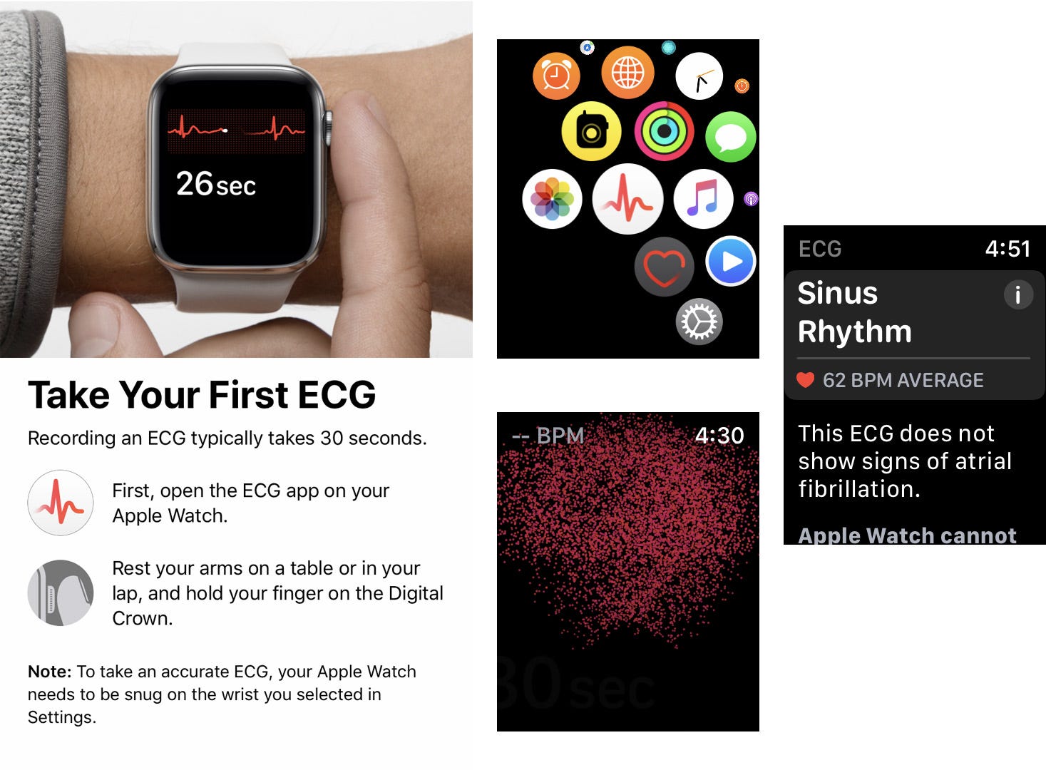 Iwatch store ekg app