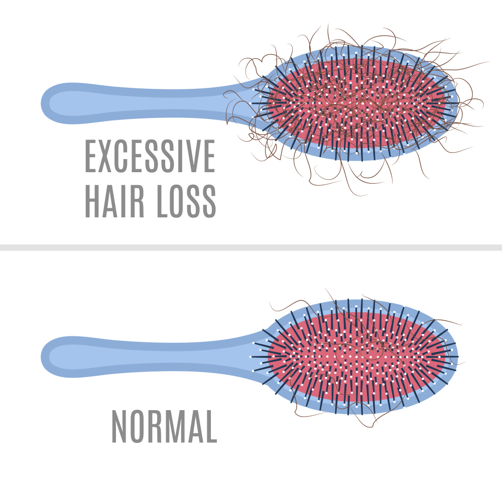 Regrow Lost Hair Naturally In 15 Minutes Donna Jenkins Medium