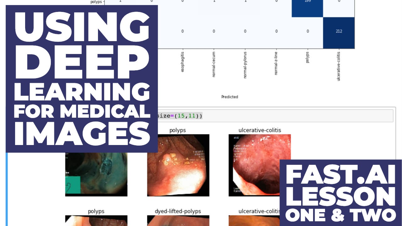How I used Deep Learning to classify medical images with Fast.ai | by ...