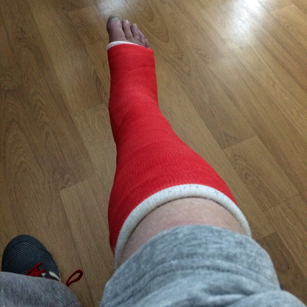 my fractured year a broken ankle diary by darryl chamberlain medium my fractured year a broken ankle diary