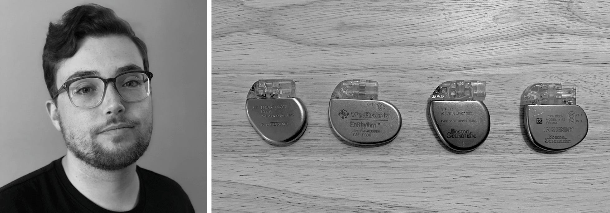 Two photos side-by-side: The author; The author’s previous cardiac devices.