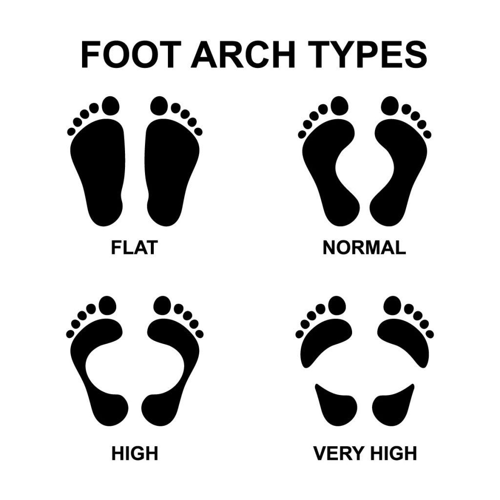 wide feet with high arches