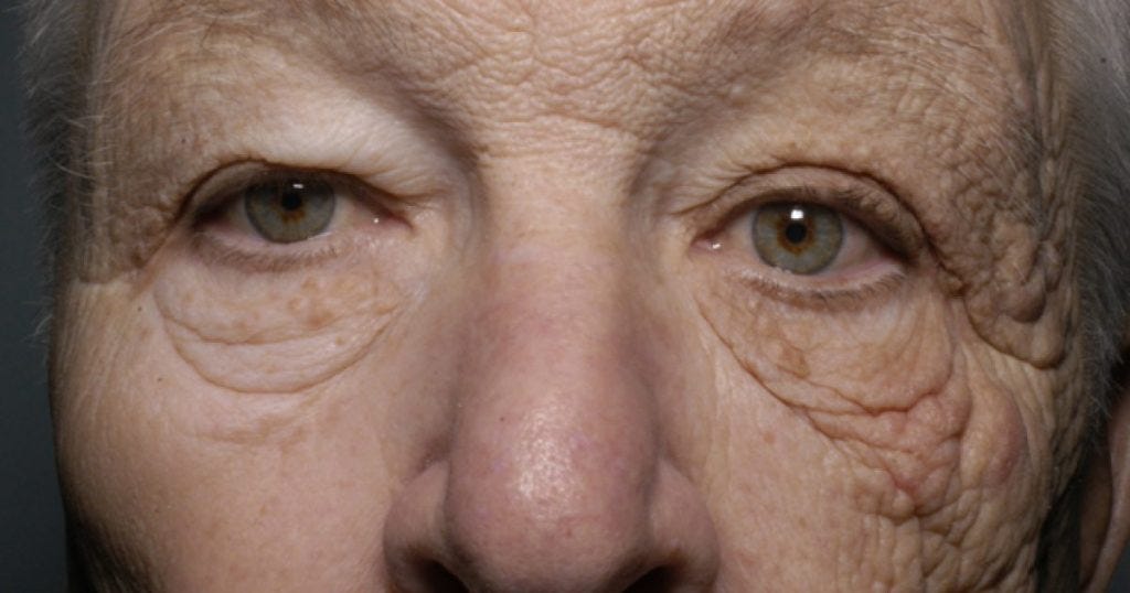 3 Photos That Will Convince You to Wear Sunscreen Every Day by