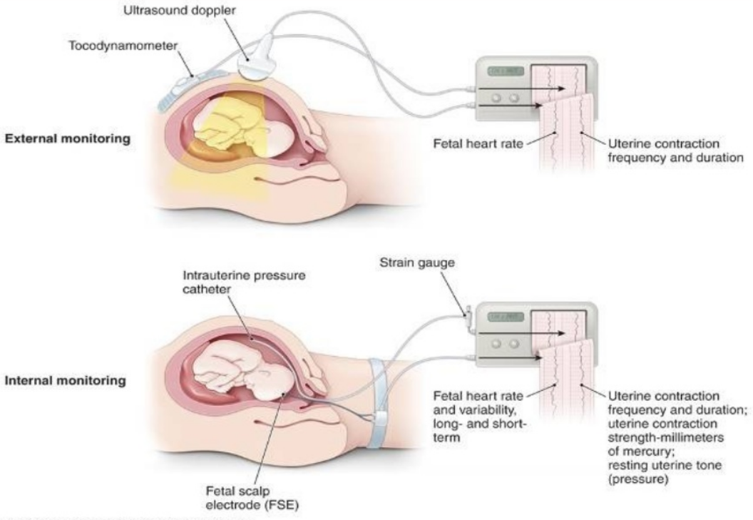 baby head heart monitor