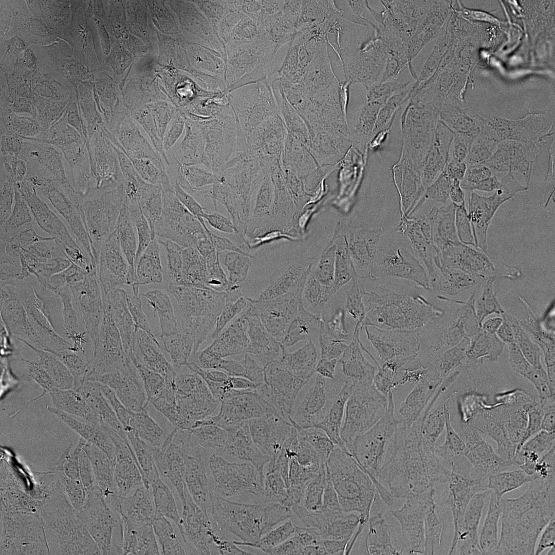 Anomaly detection in brightfield microscopy images by Nurlan Kerimov