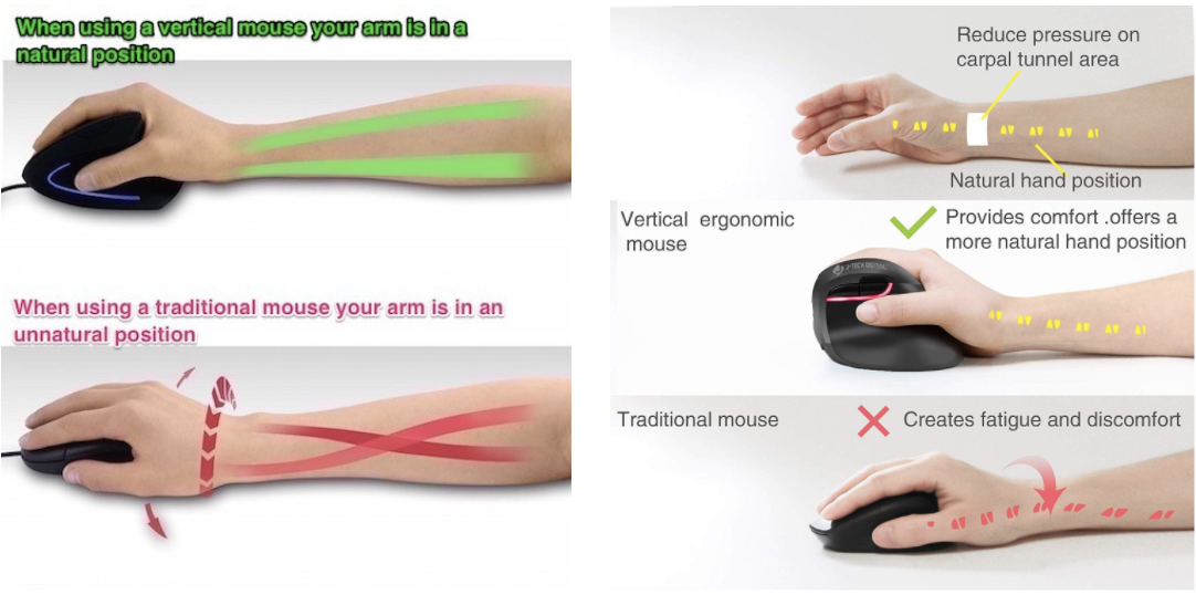 Tactical Recovery Guide for Wrist & Arm Repetitive Strain Injuries (RSI