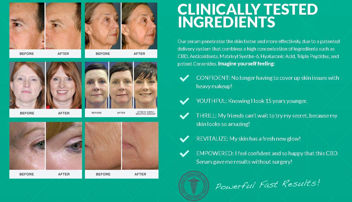 derma rpx fast acting wrinkle reducing cream