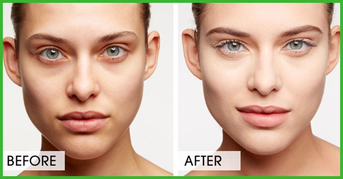 topical cream for dark circles