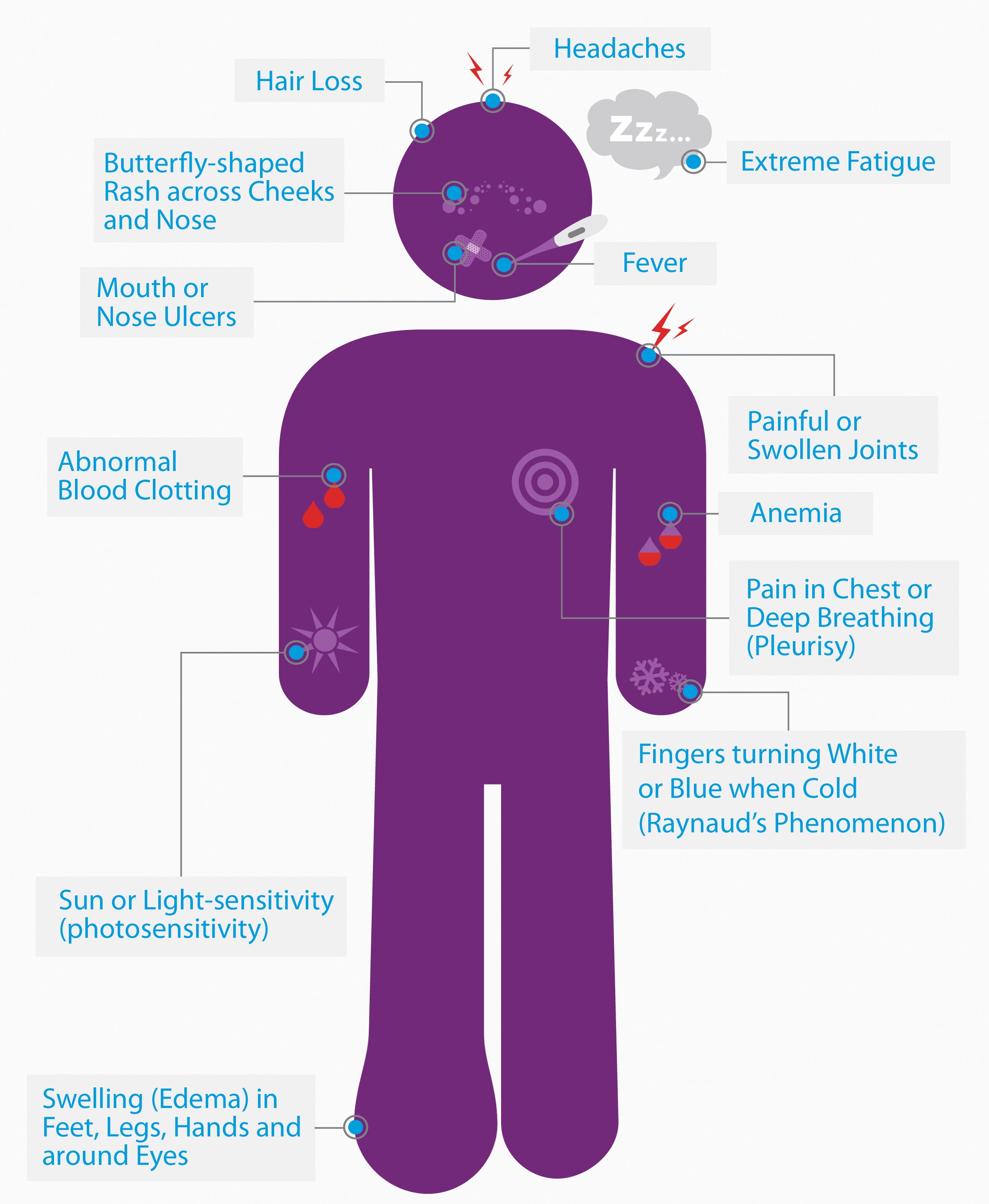 Why Rising Temperatures Could Make Life Harder for Lupus Patients