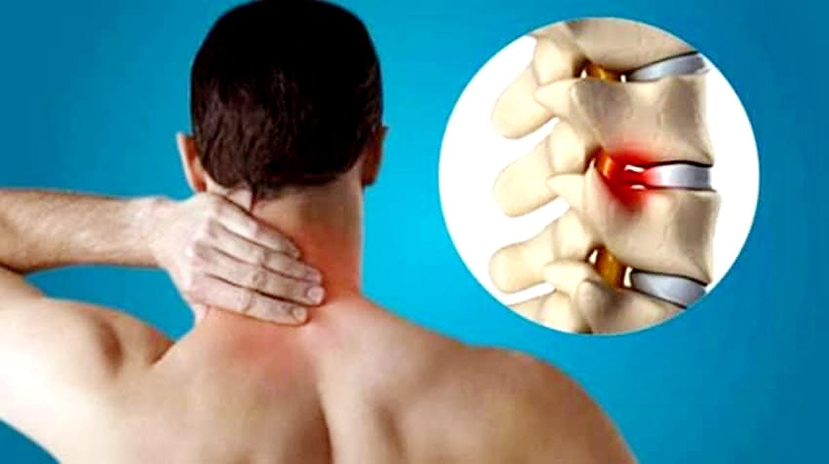 How to get relief from cervical neck pain with homeopathic medicine?