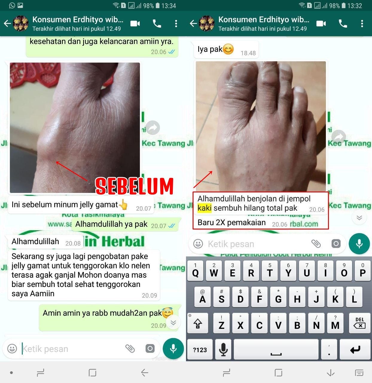5 Tips Menghilangkan Bau Jempol Kaki Menyengat Terapin Yuk
