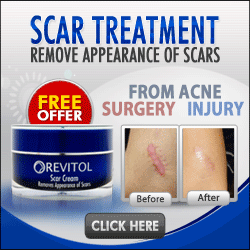 best creams for scars removal