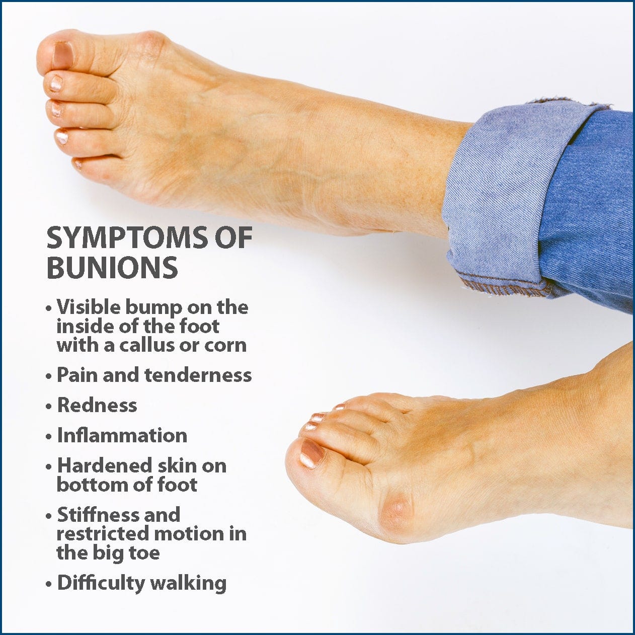 best athletic shoe for bunions
