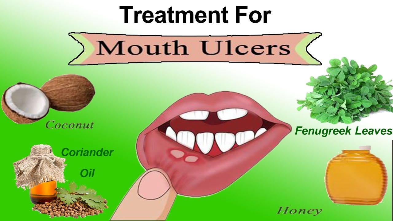 Mouth Ulcers Treatment Market Segmentation Based On Drug - 