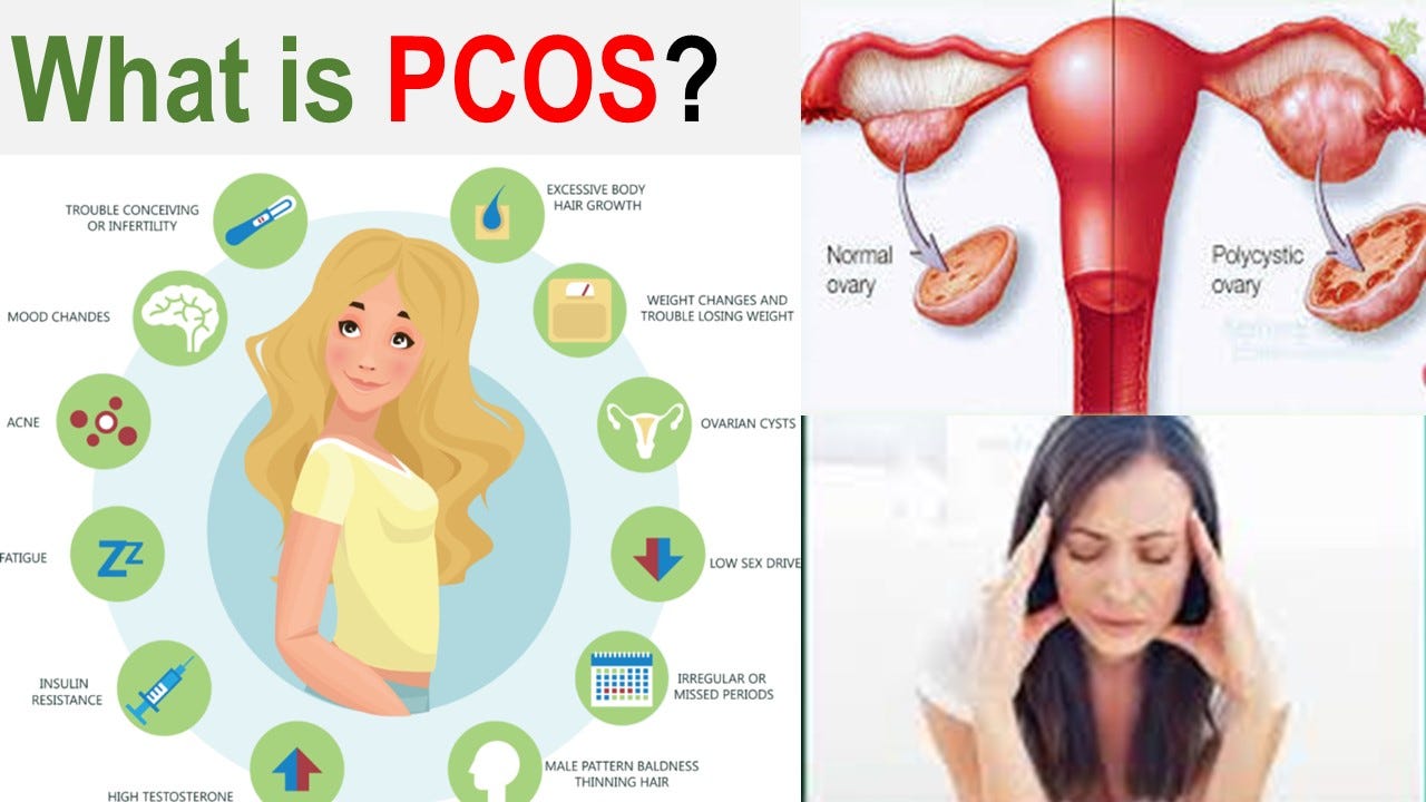 What is PCOS | Things a woman needs to know | Natural ...