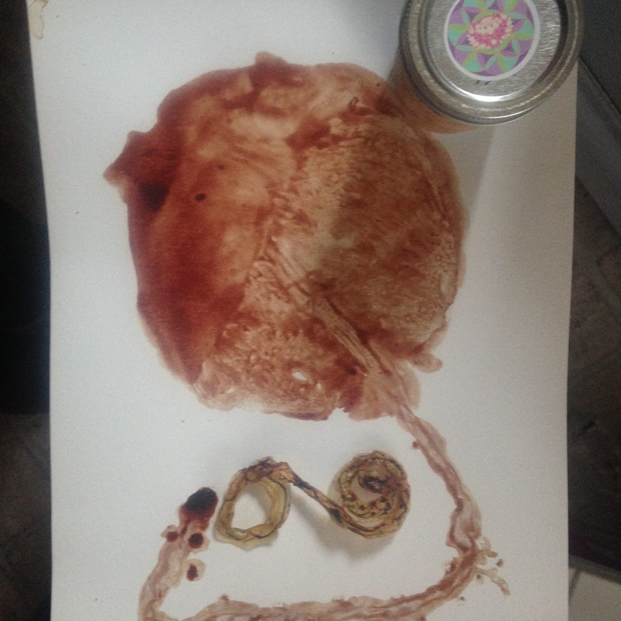 Proper Placenta Processing Responding To Cdc Concern And Professional Standards By Midwife Monika Rosicka Medium