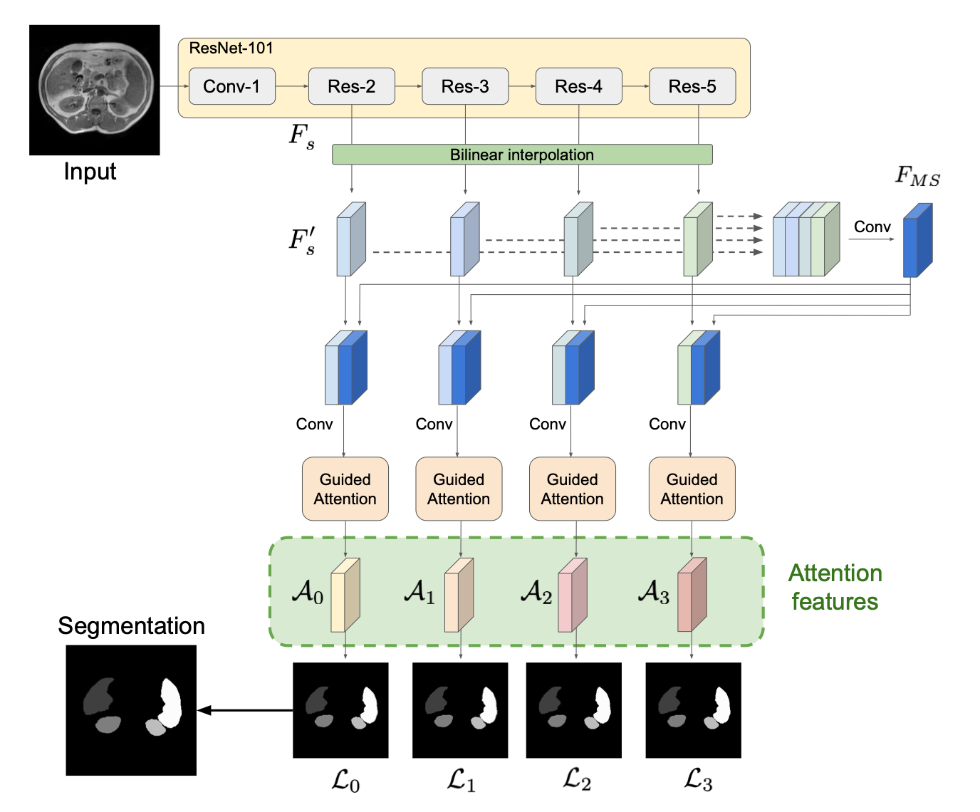 Using attention for medical image segmentation by Léo Fillioux