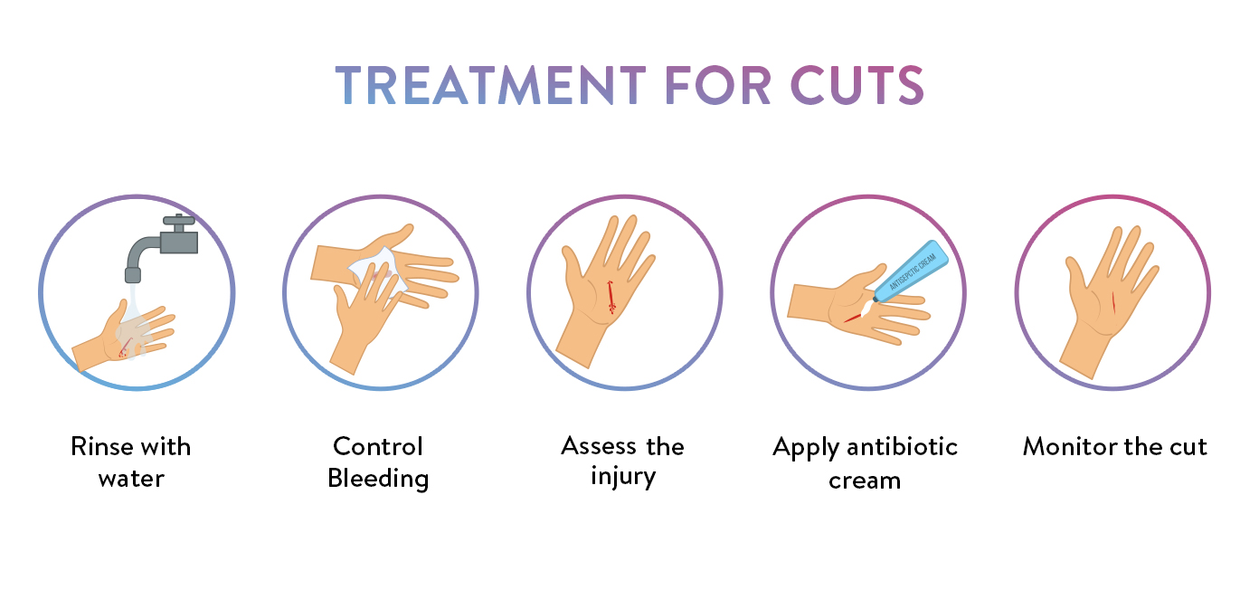 Keep Getting Small Cuts On Hands at Ramona Davis blog