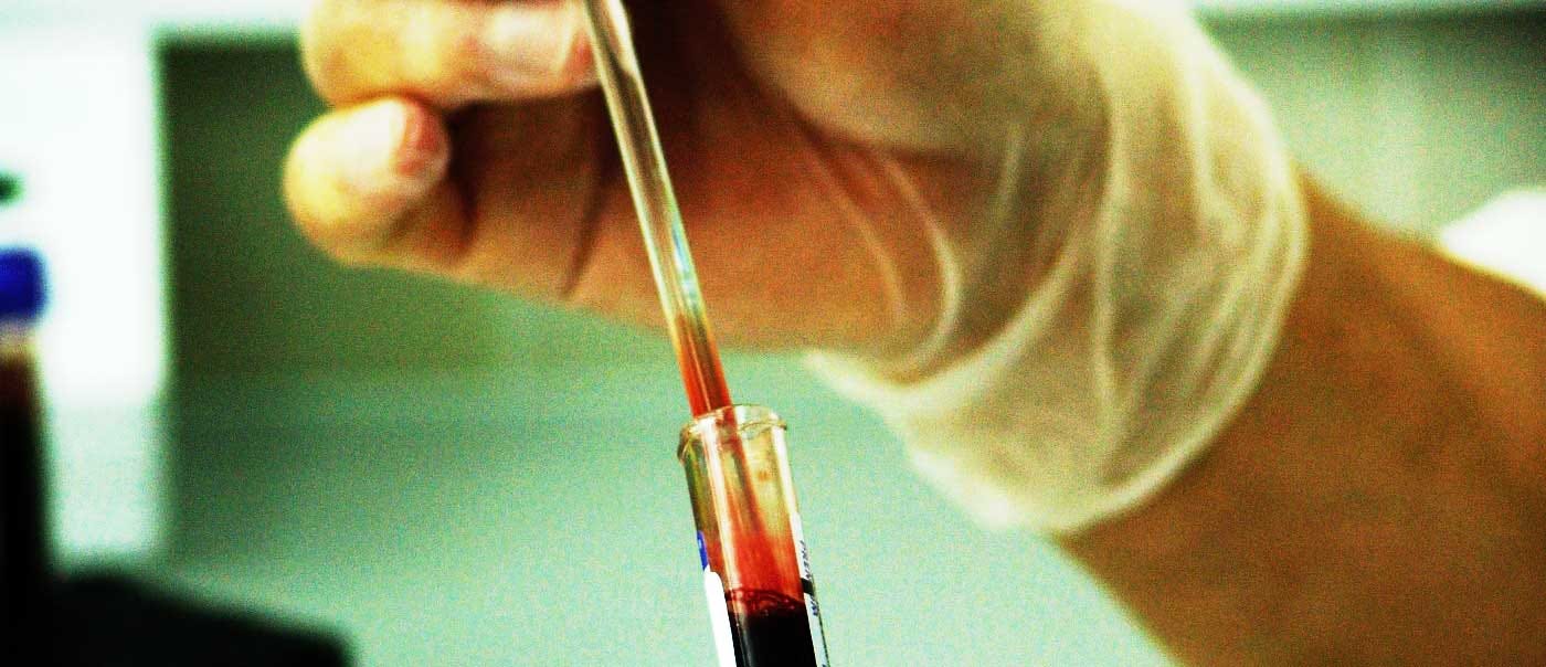 Gloved hand putting blood sample into a vial.