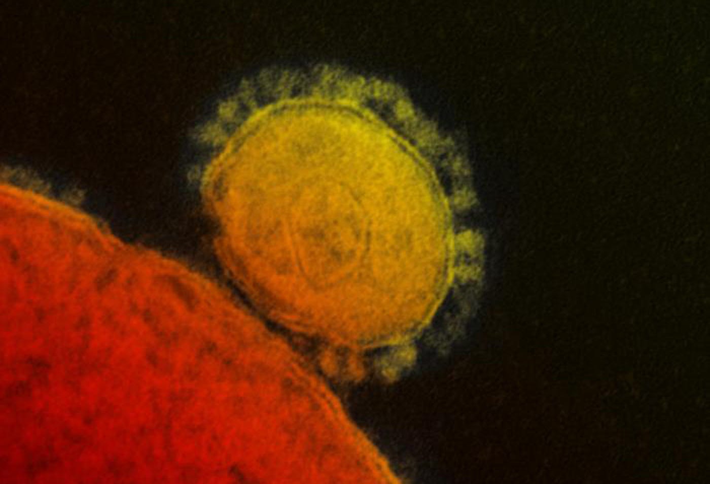 3M boosts production of facemasks as coronavirus spreads in China 3M boosts production of facemasks as coronavirus spreads in China