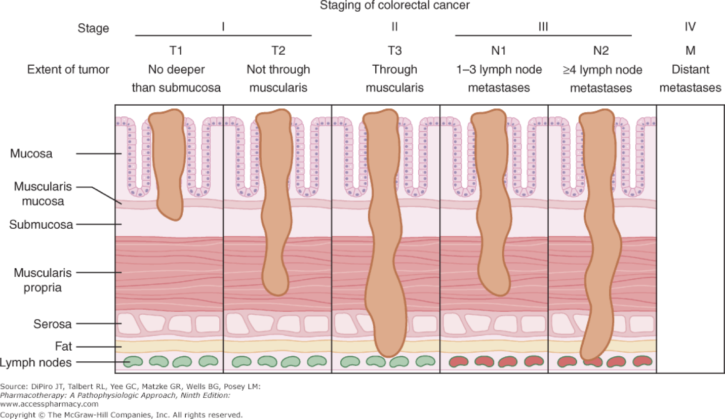 Tumor Sizes Chart Colon