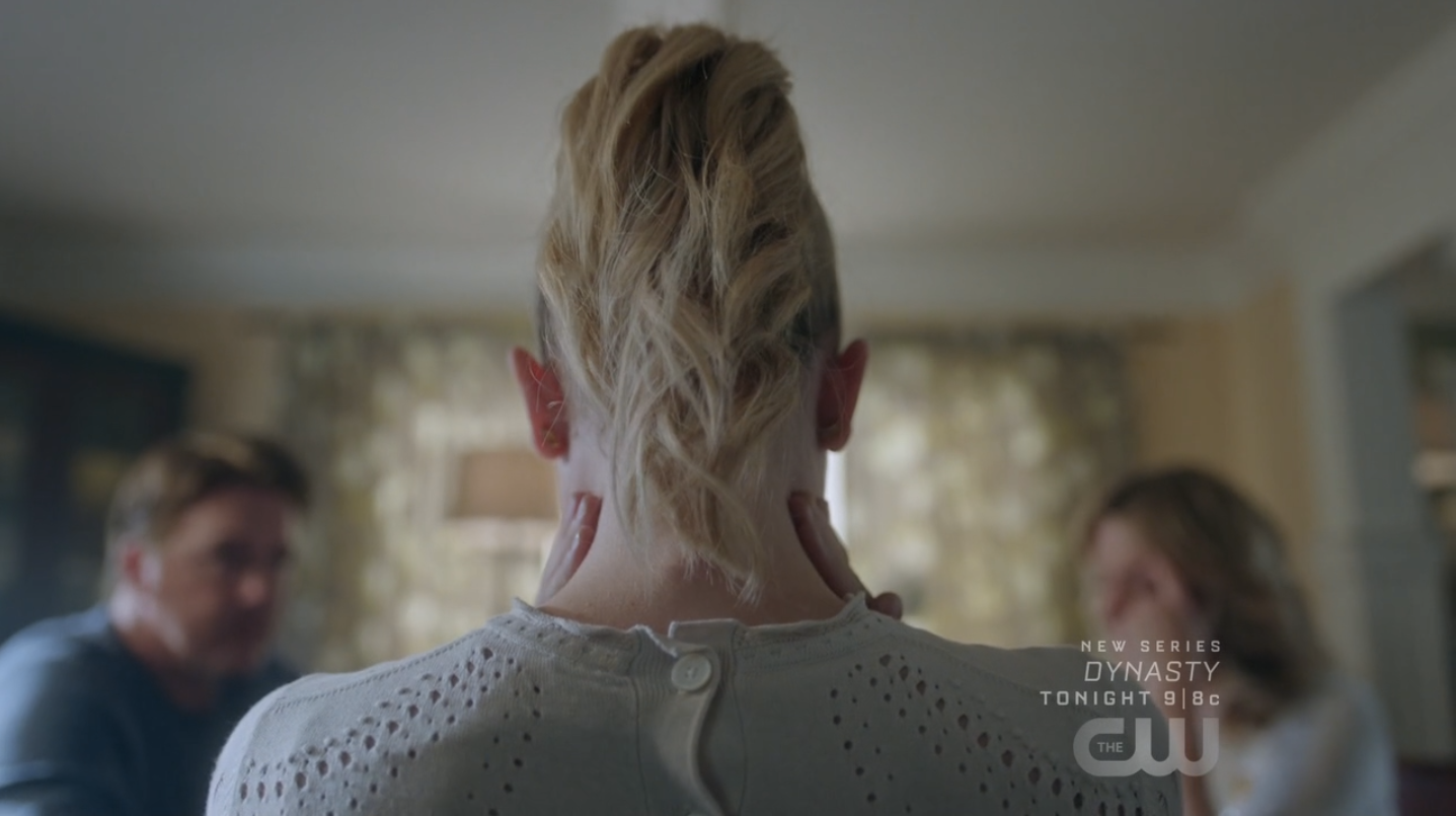 Lili Reinhart Said Her Betty Cooper Riverdale Role Caused Some Hair Damage Teen Vogue