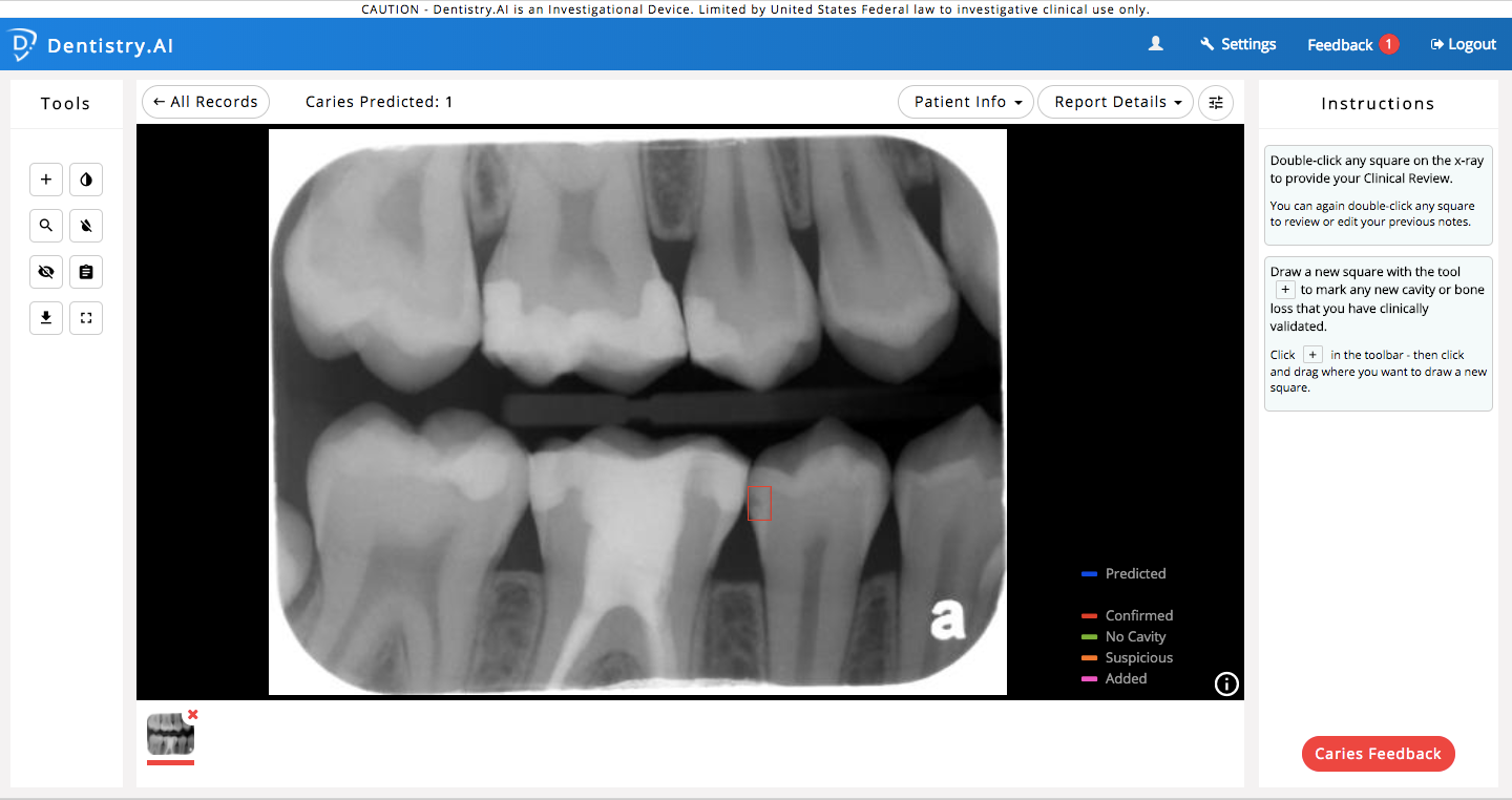 ParallelDots Starts U.S. Clinical Deployment of “Dentistry.AI