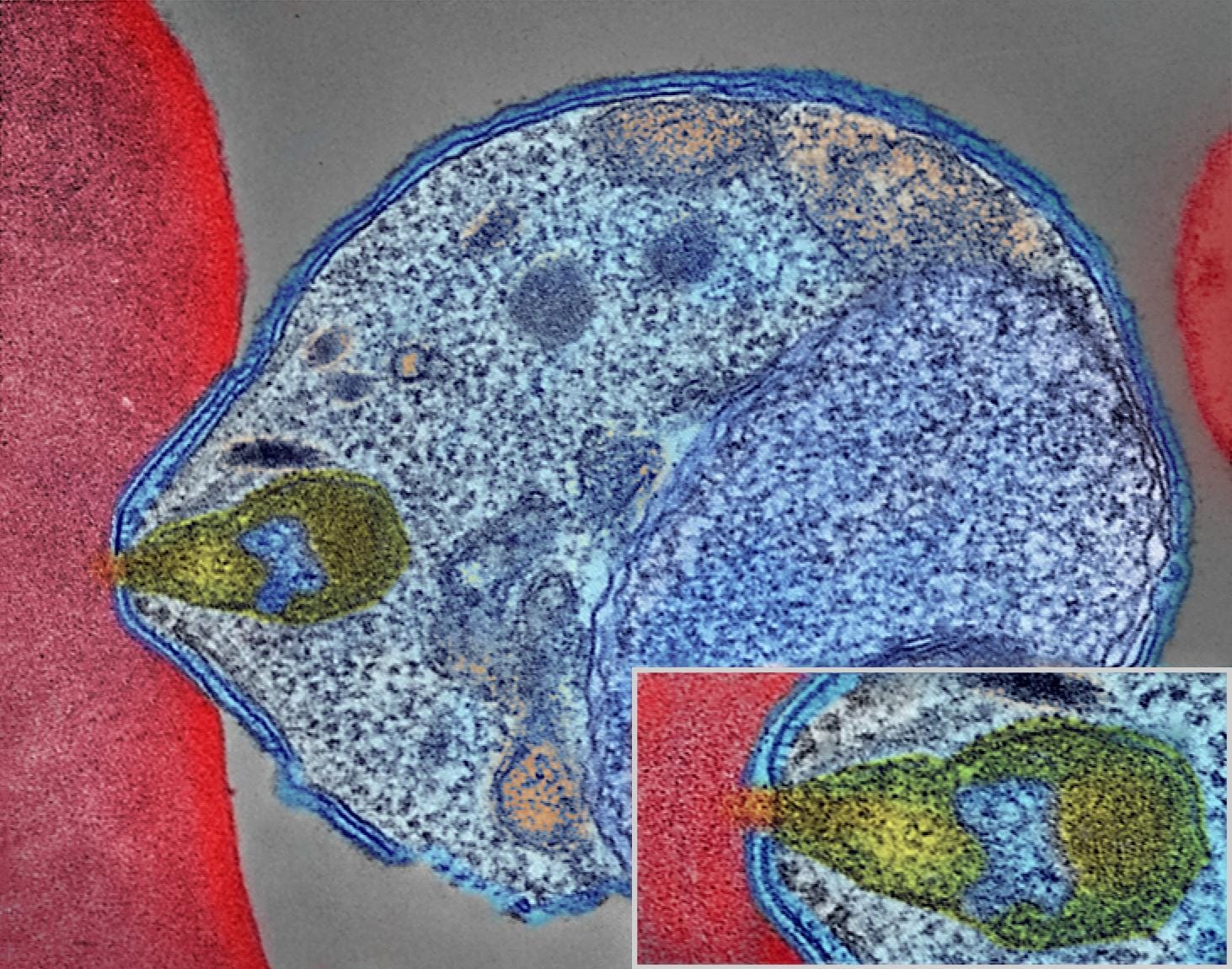 Diagnose malaria from cellphone captured microscopic ...