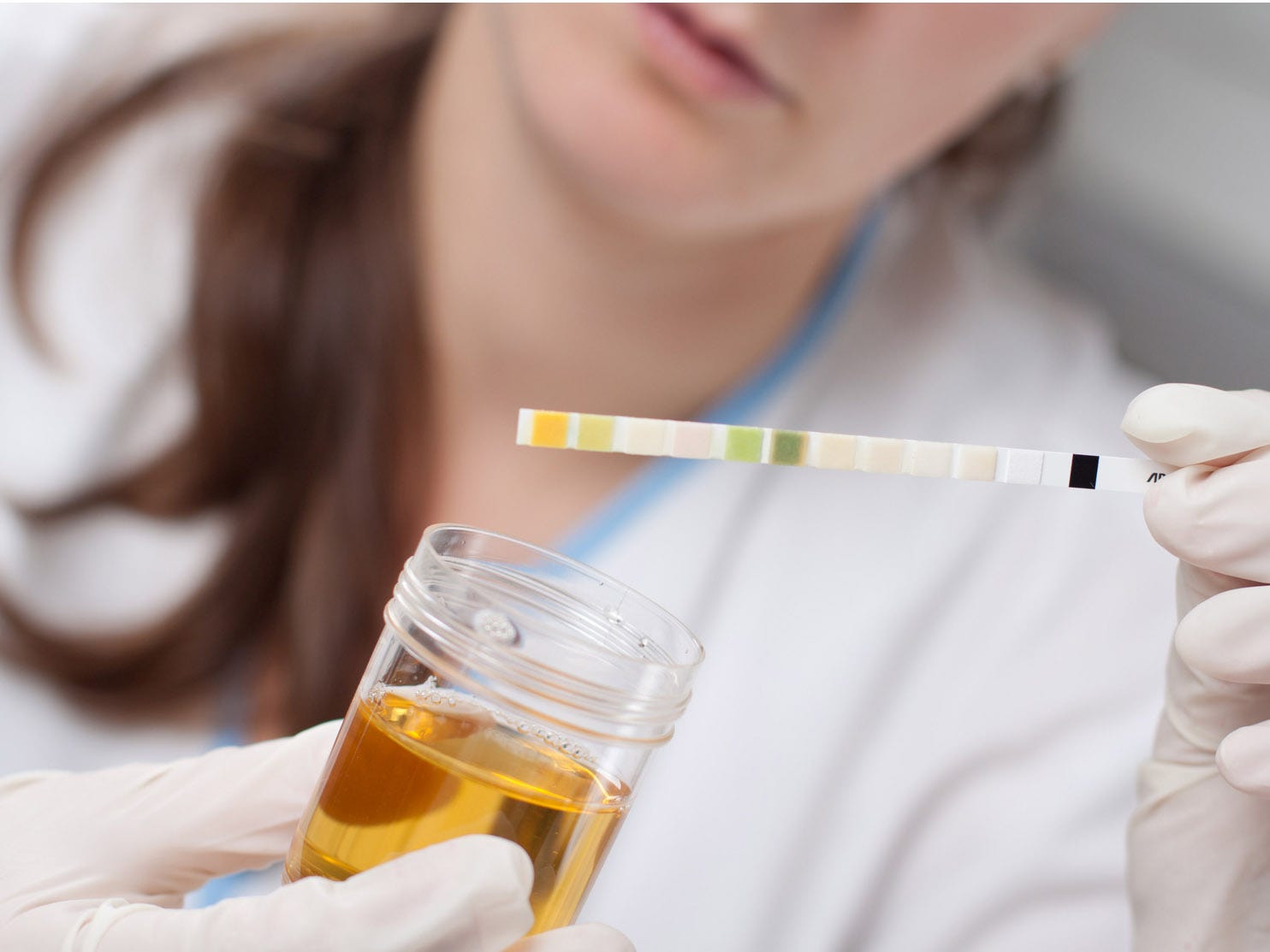 Prevention Of E Coli Urinary Tract Infection By Vaccination