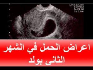 تعرف على اعراض الحمل. اعراض الحمل في الشهر الثاني بولد هو… | by ندى فهد |  Medium