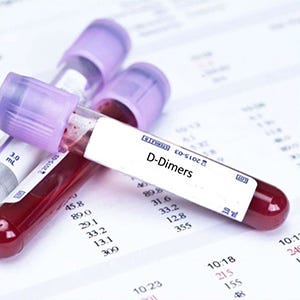 D Dimer Test Market An Upswing Technology For Testing Pulmonary