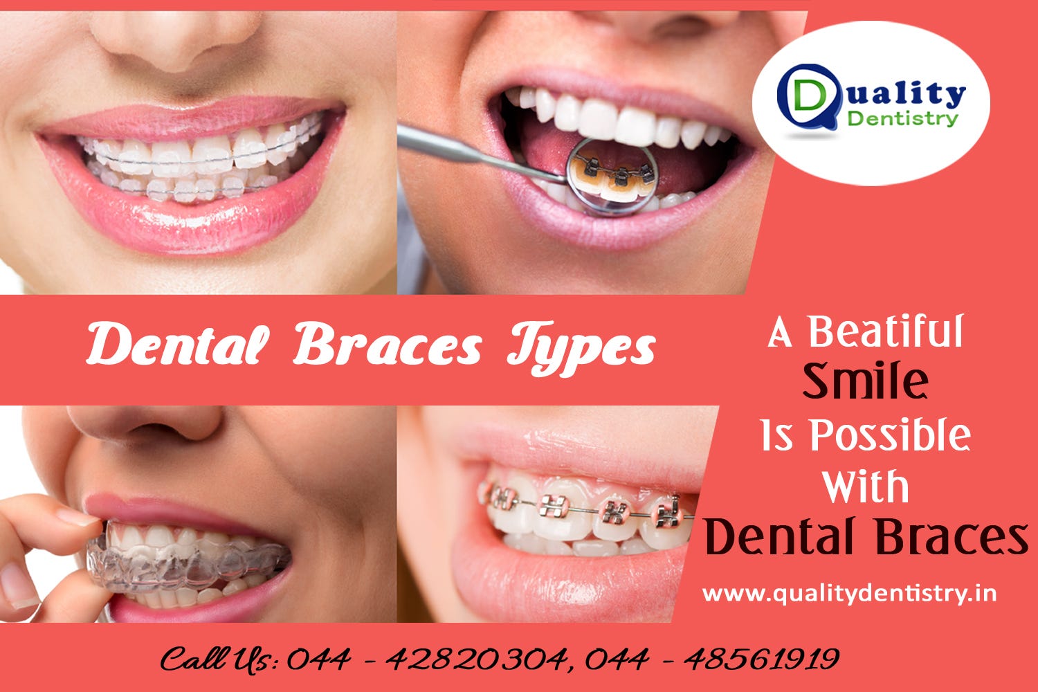 braces braces koja su legitimna besplatna web mjesta za upoznavanje