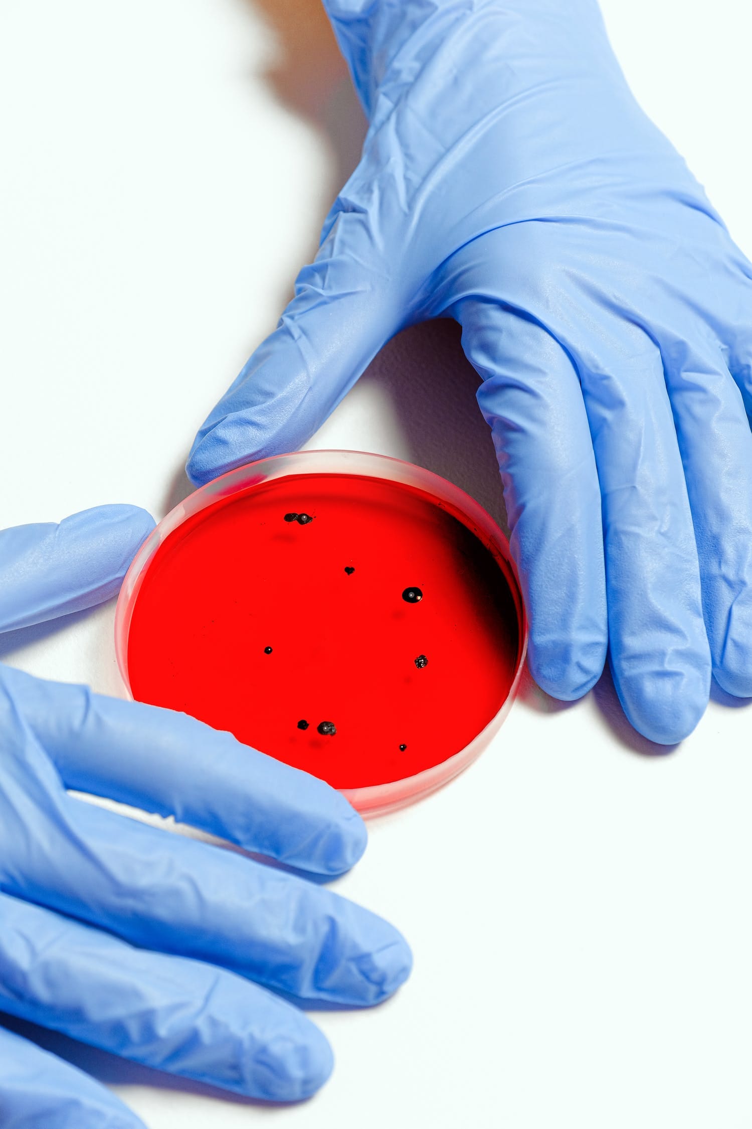 Gloved hands holding a petri dish with a bright red liquid and small black spots.