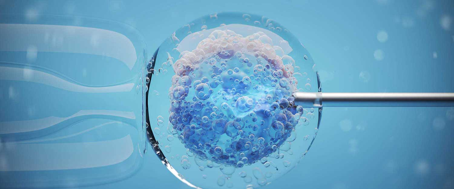 Is The Fertility Solutions Space Due For A Recovery Soon By Glg Smarter